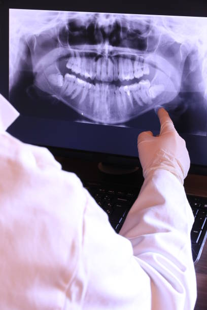 Best Emergency Dental Care for Broken or Chipped Teeth in Bunkie, LA